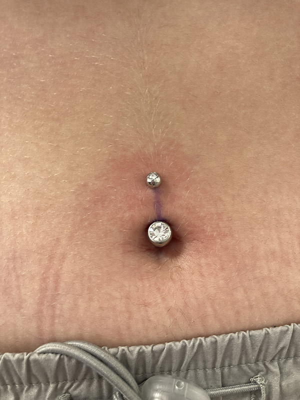 Piercing szúrás - Gönczi- Türk Emese